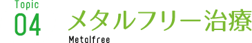 メタルフリー治療 Metalfree